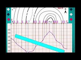 Comment réaliser un profil topographique (par Mme Ruault-Djerrab)