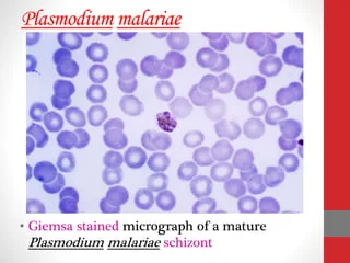 Paludisme : Plasmodium Malariae